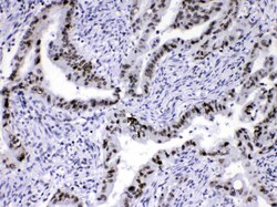 Invitrogen hnRNP A1 Polyclonal Antibody 100 &mu;g | Buy Online | Invitrogen&trade; | Fisher Scientific