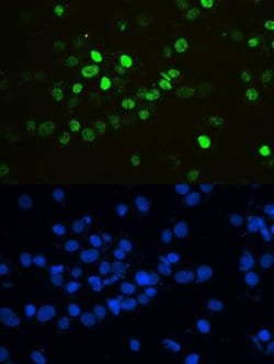 Invitrogen hnRNP F Polyclonal Antibody 100 &mu;g; Unconjugated:Antibodies,