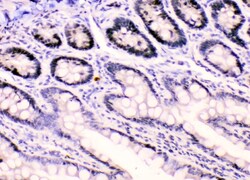 Invitrogen hnRNP F Polyclonal Antibody 100 &mu;g; Unconjugated:Antibodies,