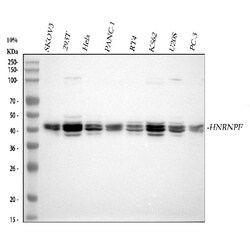 Invitrogen hnRNP F Polyclonal Antibody 100 &mu;g; Unconjugated:Antibodies,
