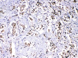 Invitrogen hnRNP F Polyclonal Antibody 100 &mu;g; Unconjugated:Antibodies,