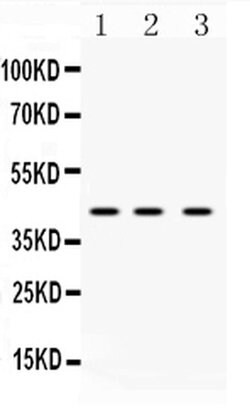 Invitrogen hnRNP F Polyclonal Antibody 100 &mu;g; Unconjugated:Antibodies,