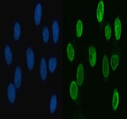 Invitrogen hnRNP L Polyclonal Antibody 100 &mu;g | Buy Online | Invitrogen&trade; | Fisher Scientific