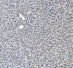 Invitrogen hnRNP L Polyclonal Antibody 100 &mu;g | Buy Online | Invitrogen&trade; | Fisher Scientific