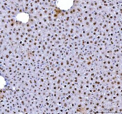 Invitrogen hnRNP L Polyclonal Antibody 100 &mu;g | Buy Online | Invitrogen&trade; | Fisher Scientific