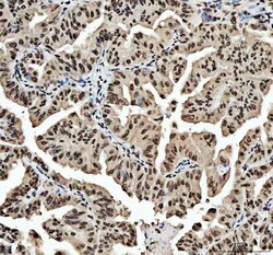 Invitrogen hnRNP L Polyclonal Antibody 100 &mu;g | Buy Online | Invitrogen&trade; | Fisher Scientific