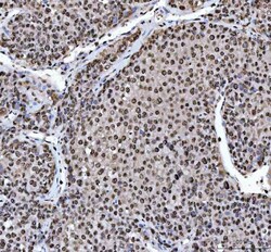 Invitrogen hnRNP L Polyclonal Antibody 100 &mu;g | Buy Online | Invitrogen&trade; | Fisher Scientific