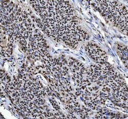 Invitrogen hnRNP L Polyclonal Antibody 100 &mu;g | Buy Online | Invitrogen&trade; | Fisher Scientific