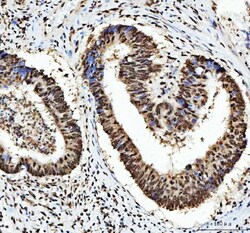 Invitrogen hnRNP L Polyclonal Antibody 100 &mu;g | Buy Online | Invitrogen&trade; | Fisher Scientific