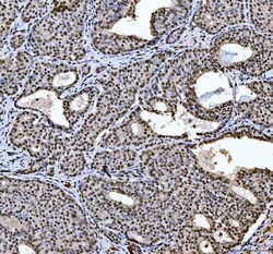 Invitrogen hnRNP L Polyclonal Antibody 100 &mu;g | Buy Online | Invitrogen&trade; | Fisher Scientific