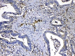 Invitrogen HOMER3 Polyclonal Antibody 100 &mu;g; Unconjugated:Antibodies,