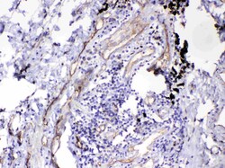 Invitrogen HOMER3 Polyclonal Antibody 100 &mu;g; Unconjugated:Antibodies,