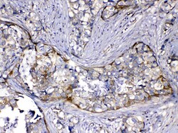 Invitrogen HOMER3 Polyclonal Antibody 100 &mu;g; Unconjugated:Antibodies,