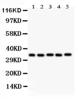 Invitrogen HOXA11 Polyclonal Antibody 100 &mu;g; Unconjugated:Antibodies,