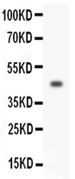 Invitrogen HOXA3 Polyclonal Antibody 100 &mu;g | Buy Online | Invitrogen&trade; | Fisher Scientific
