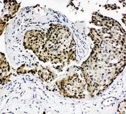 Invitrogen HOXA4 Polyclonal Antibody 100 &mu;g; Unconjugated:Antibodies,