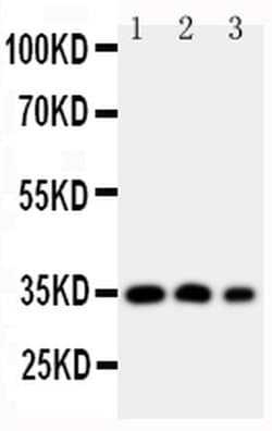 Invitrogen HOXA4 Polyclonal Antibody 100 &mu;g; Unconjugated:Antibodies,