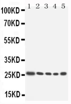 Invitrogen HOXA6 Polyclonal Antibody 100 &mu;g; Unconjugated:Antibodies,