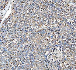 Invitrogen HSD11B1 Polyclonal Antibody 100 &mu;g; Unconjugated:Antibodies,
