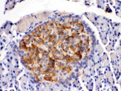 Invitrogen HSD11B2 Polyclonal Antibody 100 &mu;g; Unconjugated:Antibodies,