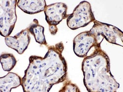 Invitrogen HSD11B2 Polyclonal Antibody 100 &mu;g; Unconjugated:Antibodies,