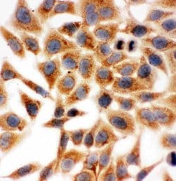 Invitrogen HSD17B1 Polyclonal Antibody 100 &mu;g; Unconjugated:Antibodies,