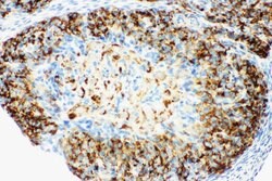 Invitrogen HSD17B1 Polyclonal Antibody 100 &mu;g; Unconjugated:Antibodies,