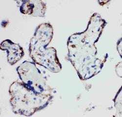 Invitrogen HSD17B1 Polyclonal Antibody 100 &mu;g; Unconjugated:Antibodies,
