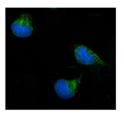 Invitrogen ERAB Polyclonal Antibody 100 &mu;g; Unconjugated:Antibodies,