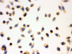 Invitrogen ERAB Polyclonal Antibody 100 &mu;g; Unconjugated:Antibodies,