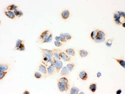 Invitrogen ERAB Polyclonal Antibody 100 &mu;g; Unconjugated:Antibodies,