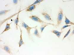 Invitrogen ERAB Polyclonal Antibody 100 &mu;g; Unconjugated:Antibodies,