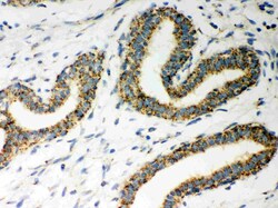 Invitrogen ERAB Polyclonal Antibody 100 &mu;g; Unconjugated:Antibodies,