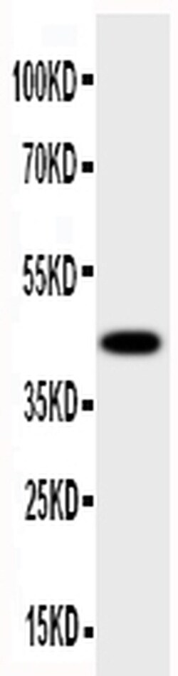 Invitrogen HSD17B2 Polyclonal Antibody 100 &mu;g | Buy Online | Invitrogen&trade; | Fisher Scientific