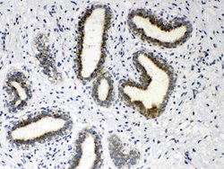 Invitrogen HSD17B4 Polyclonal Antibody 100 &mu;g; Unconjugated:Antibodies,