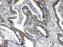 Invitrogen HSD17B4 Polyclonal Antibody 100 &mu;g; Unconjugated:Antibodies,
