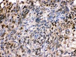 Invitrogen HSPA2 Polyclonal Antibody 100 &mu;g; Unconjugated:Antibodies,