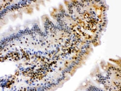 Invitrogen HSPA2 Polyclonal Antibody 100 &mu;g; Unconjugated:Antibodies,