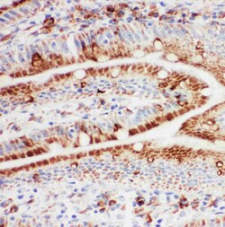 Invitrogen HSP105 Polyclonal Antibody 100 &mu;g | Buy Online | Invitrogen&trade; | Fisher Scientific