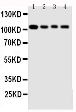 Invitrogen HSP105 Polyclonal Antibody 100 &mu;g | Buy Online | Invitrogen&trade; | Fisher Scientific