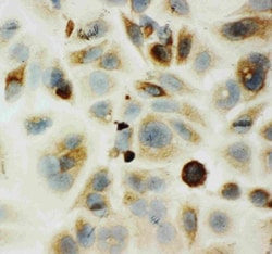 Invitrogen&trade;&nbsp;HYAL1 Polyclonal Antibody