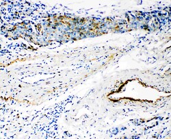 Invitrogen HYAL3 Polyclonal Antibody 100 &mu;g | Buy Online | Invitrogen&trade; | Fisher Scientific