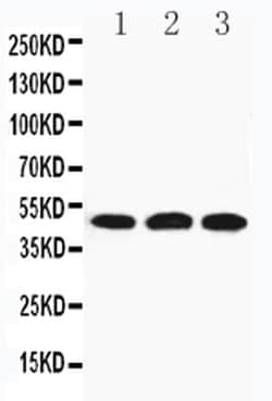 Invitrogen HYAL3 Polyclonal Antibody 100 &mu;g | Buy Online | Invitrogen&trade; | Fisher Scientific