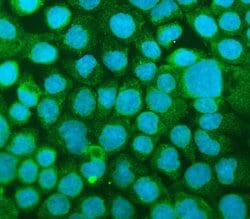 Invitrogen ICAM-1 (CD54) Polyclonal Antibody 100 &mu;g; Unconjugated:Antibodies,