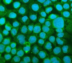 Invitrogen ICAM-1 (CD54) Polyclonal Antibody 100 &mu;g; Unconjugated:Antibodies,
