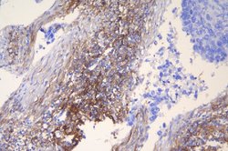 Invitrogen ICAM-1 (CD54) Polyclonal Antibody 100 &mu;g; Unconjugated:Antibodies,