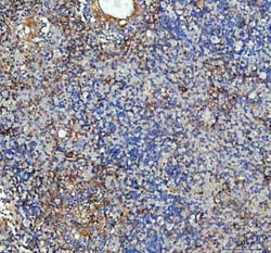 Invitrogen ICAM-1 (CD54) Polyclonal Antibody 100 &mu;g; Unconjugated:Antibodies,