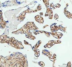 Invitrogen ICAM-1 (CD54) Polyclonal Antibody 100 &mu;g; Unconjugated:Antibodies,