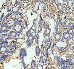 Invitrogen ICAM-1 (CD54) Polyclonal Antibody 100 &mu;g; Unconjugated:Antibodies,