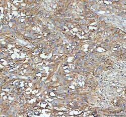 Invitrogen ICAM-1 (CD54) Polyclonal Antibody 100 &mu;g; Unconjugated:Antibodies,